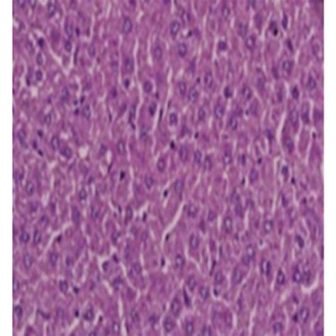 Representative Photomicrographs Of Liver Histopathology Liver Sections