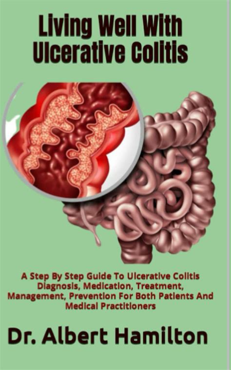 Living Well With Ulcerative Colitis A Step By Step Guide To Ulcerative