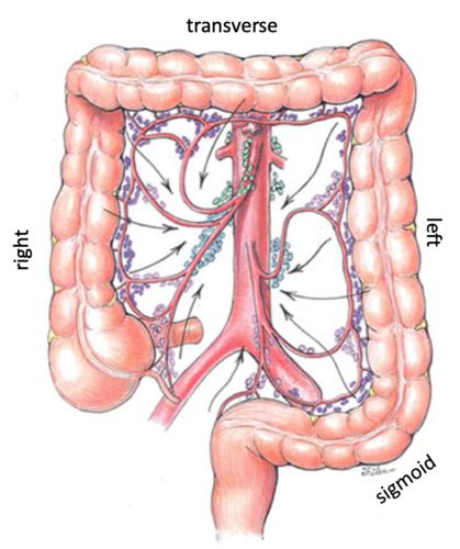 Colorectal Surgery Flashcards Quizlet