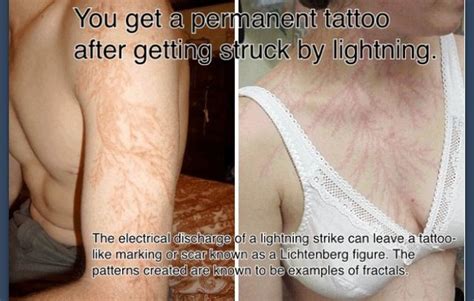 Thats Actually Pretty Cool Lightning Scar Lichtenberg Figures Lightning Strikes