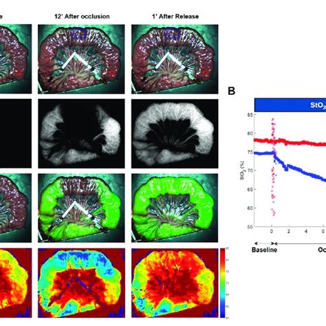 In-vivo results: Fluorescence and oxygenation imaging: (A) Images ...