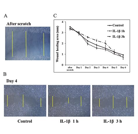 Wound healing analyses on re-epithelialization. Re-epithelialization in ...