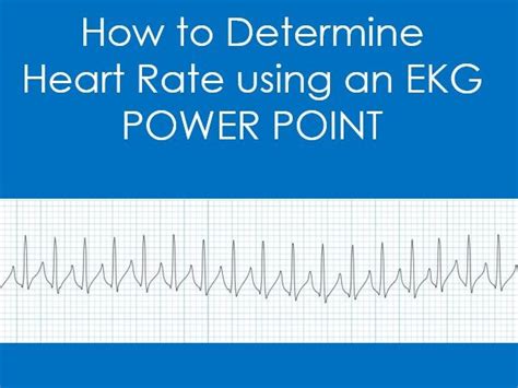 How To Determine Heart Rate Using An Ekg Strip Power Point Teaching Resources