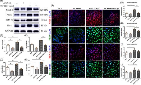 The Notch Signalling Pathway Participates In EMT Induced By CNPase