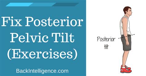 How To Fix Posterior Pelvic Tilt - Best Stretches & Exercises