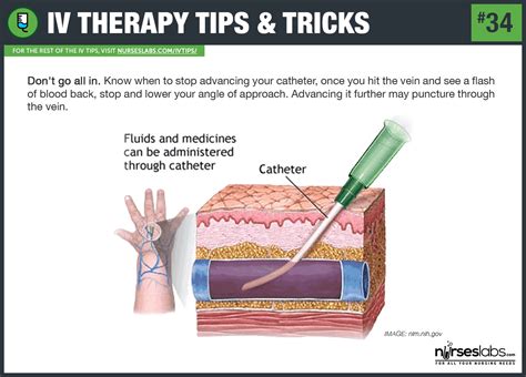 50 IV Therapy Tips And Tricks How To Hit The Vein In One Shot