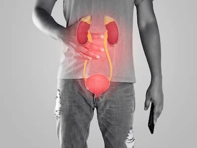 Chronic Interstitial Nephritis (Kidney Inflammation): Causes, Symptoms ...