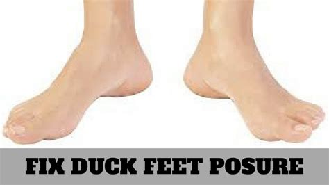 Correcting Duck Feet Posture Youtube