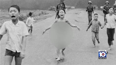 Famous ‘napalm Girl From Defining Vietnam War Photo Visits South Florida For Last Treatment