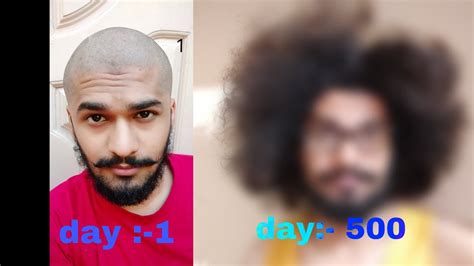 500 Days Of Hair Growth Time Lapse Picture A Day Youtube