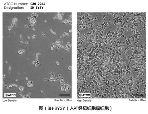 Sh Sy5y细胞培养攻略公司新闻丁香通