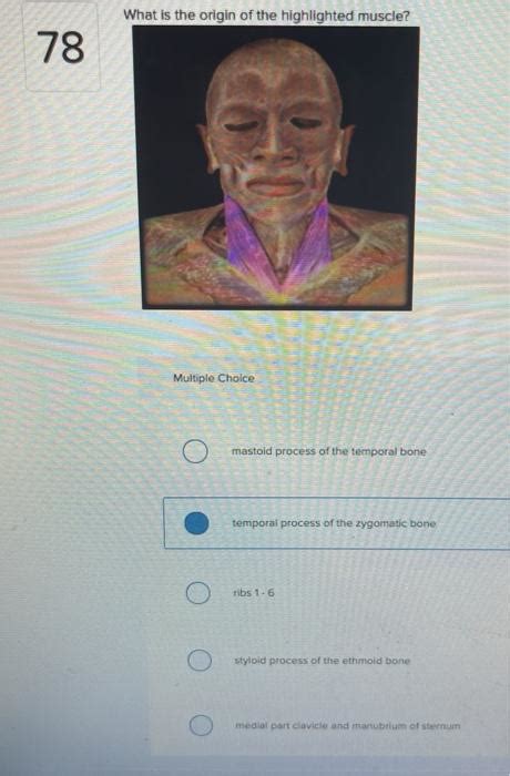 Question What Is The Origin Of The Highlighted Muscle 78 Multiple