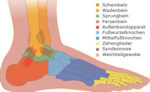 Loch Faulheit Auerochse B Nderriss Fu Tapen Vergleichbar Diagonal Bedeckt