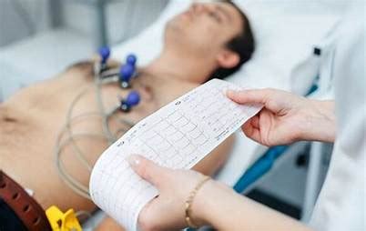 How is an ECG performed? | Cardiac X