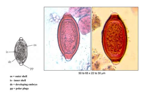 Trichuris Diagram Quizlet