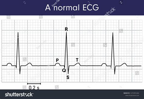 Normal Ecg Stock Vector (Royalty Free) 1272391264 | Shutterstock