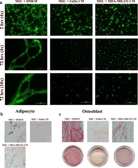 Mscs Exposed To Tumor Cm Lose Their Multipotent Differentiation