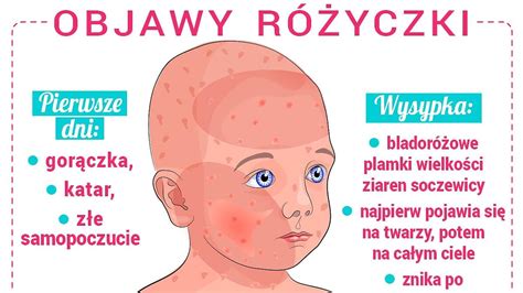 Jak wygląda wysypka różyczki