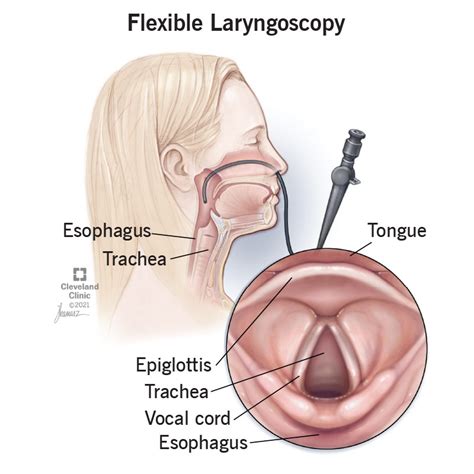 Laryngoscopy Procedure Definition Types 48 Off