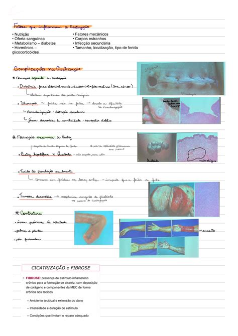 Reparo Tecidual Patologia I