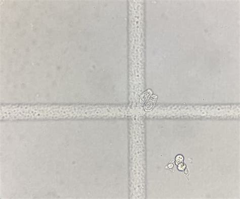 Renal Epithelial Cells In Urine