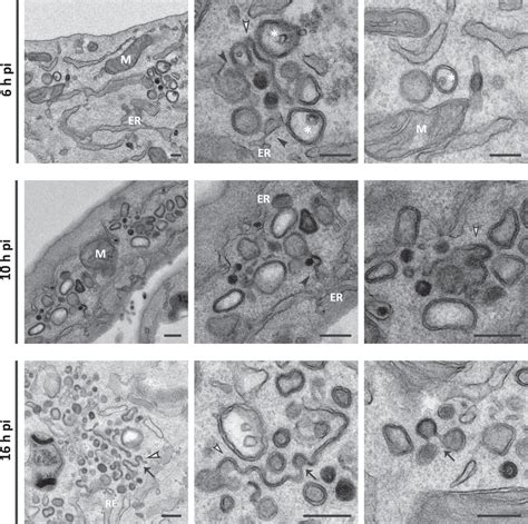 DMVsassociated Membranous Network Induced By BEV Infection Electron