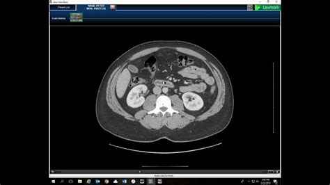 Gross Anatomy Cross Sections Of The Abdomen And Pelvis Part 3