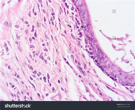 Histology Human Submaxillary Gland Tissue Show Foto De Stock Hot Sex