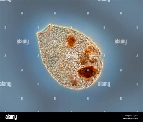 Amoeba Under Microscope X Labeled