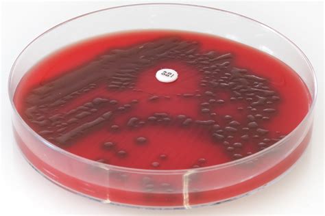 Streptococcus Pneumoniae Culture