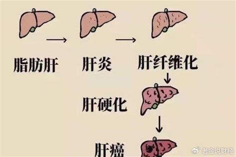 身体这2处发痒，或是肝病“示警”，请尽早查一查