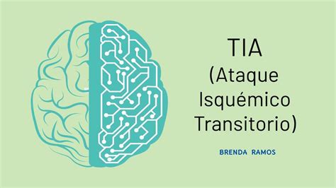 Ataque isquémico transitorio Brenda Ramos uDocz