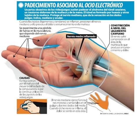 Ems Solutions International By Drramonreyesmd Marca Registrada