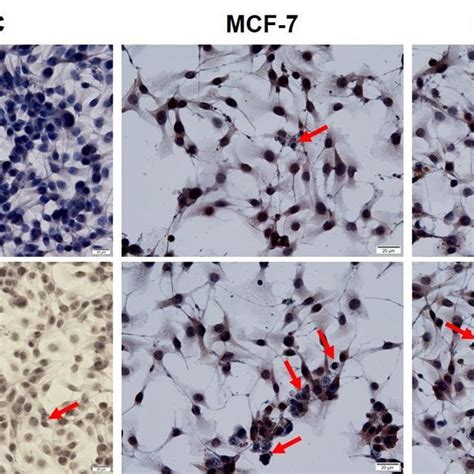 Tunel Staining For Apoptosis In Adscs Mcf 7 And Mda Mb 231 Breast Download Scientific Diagram