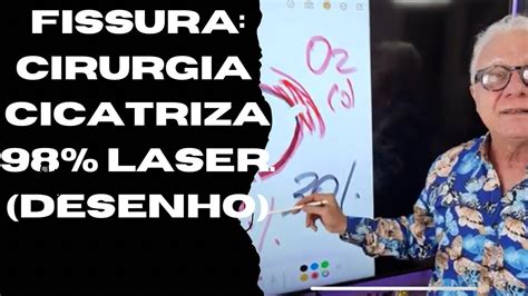 Fissura Cirurgia Laser Cicatriza 98 Sem Incontinência Anal C 36 Anos