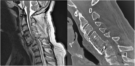 Pre Operative Mri And Ct Download Scientific Diagram