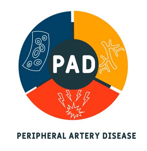 Peripheral Arteries Illustrations Royalty Free Vector Graphics And Clip Art Istock