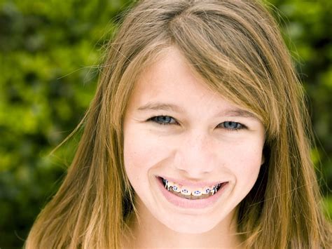 How Do Elastics Rubber Bands Help My Smile Mcfarland Orthodontics