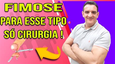 Tipos De Fimose Fimose Tipo Grau 5 O Tipo De Fimose Mais Grave