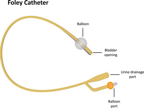 Induction Methods - Balloon Catheter | Back to Basics Birthing