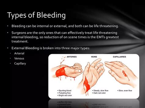 bls care  bleeding  shock pptx