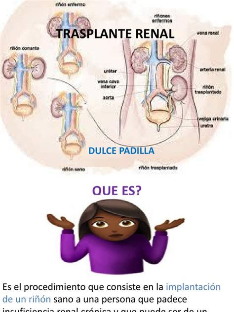 Trasplante Renal | Transplante de organo | Medicina