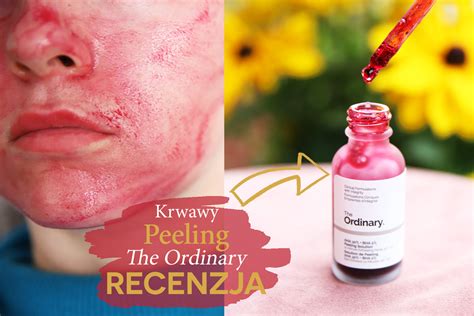 Krwawy Peeling Kwasowy The Ordinary AHA 30 BHA 2 Moja Opinia Jak