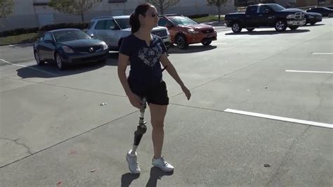 Walks For First Time Hip Disarticulate Amputee Best Prosthesis Best Artificial Limbs In