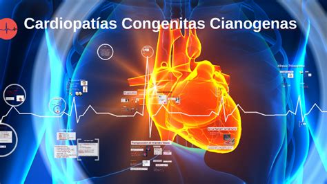 Cardiopatías Congenitas Cianogenas by Joseina Contreras on Prezi