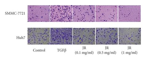 JR inhibits TGFβ1 induced migration and invasion of HCC cells The