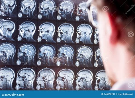 Exploración De Mri De La Cabeza Y Del Cerebro Doctor En Primero Plano