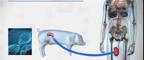 Un Rinichi De Porc Continua Sa Functioneze De Peste O Luna In Corpul