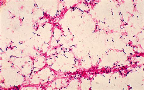 Streptococcus Pneumoniae