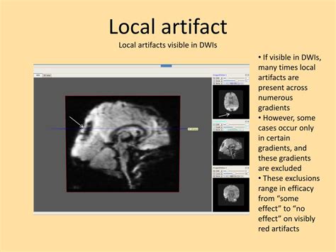 Ppt Dti Artifacts In Ibis Data Visible In Color Fa Powerpoint